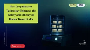 Lyophilization of Human Tissue