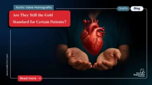 Aortic valve allogarfts