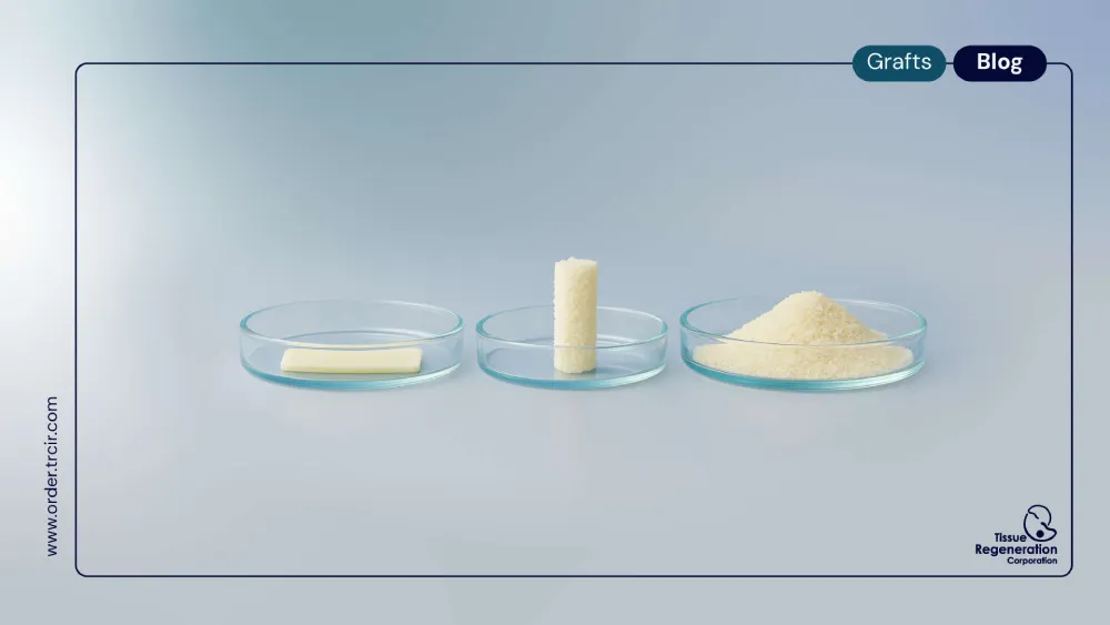allograft for spinal fusion
