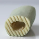 femoral shaft