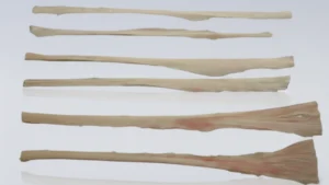 knee ligament reconstruction