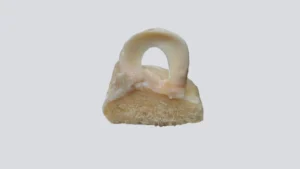 meniscus