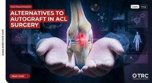alternatives to autograft in ACL surgery